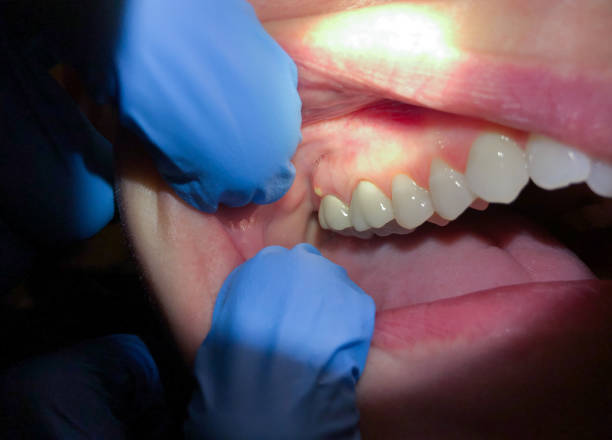 Best Pediatric Emergency Dentist in Rkville, PA