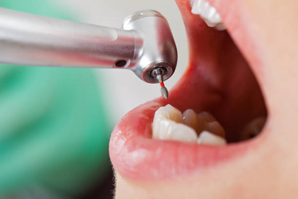 Best Emergency Broken Tooth Repair in Rkville, PA